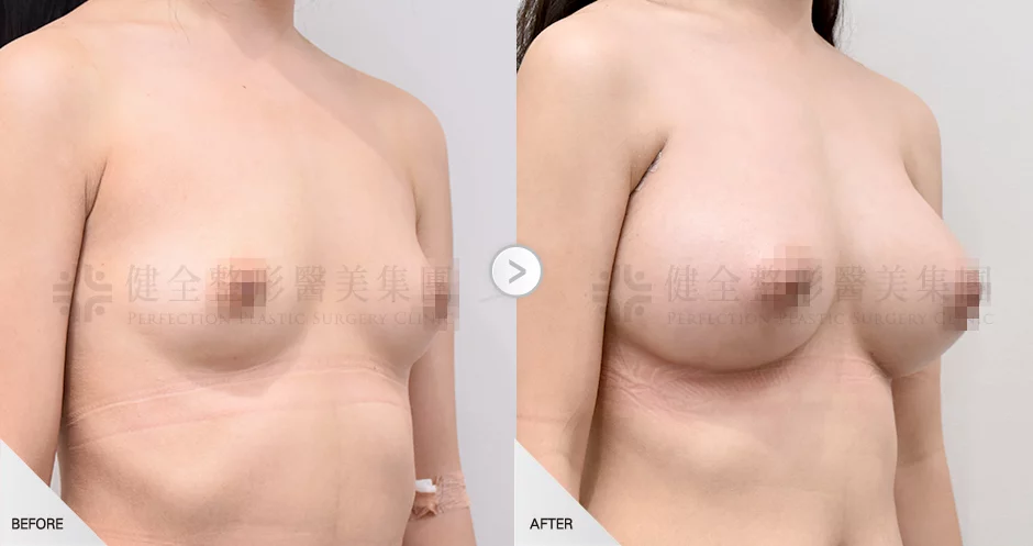 118f1c7bb081417a82fe1624b6571760