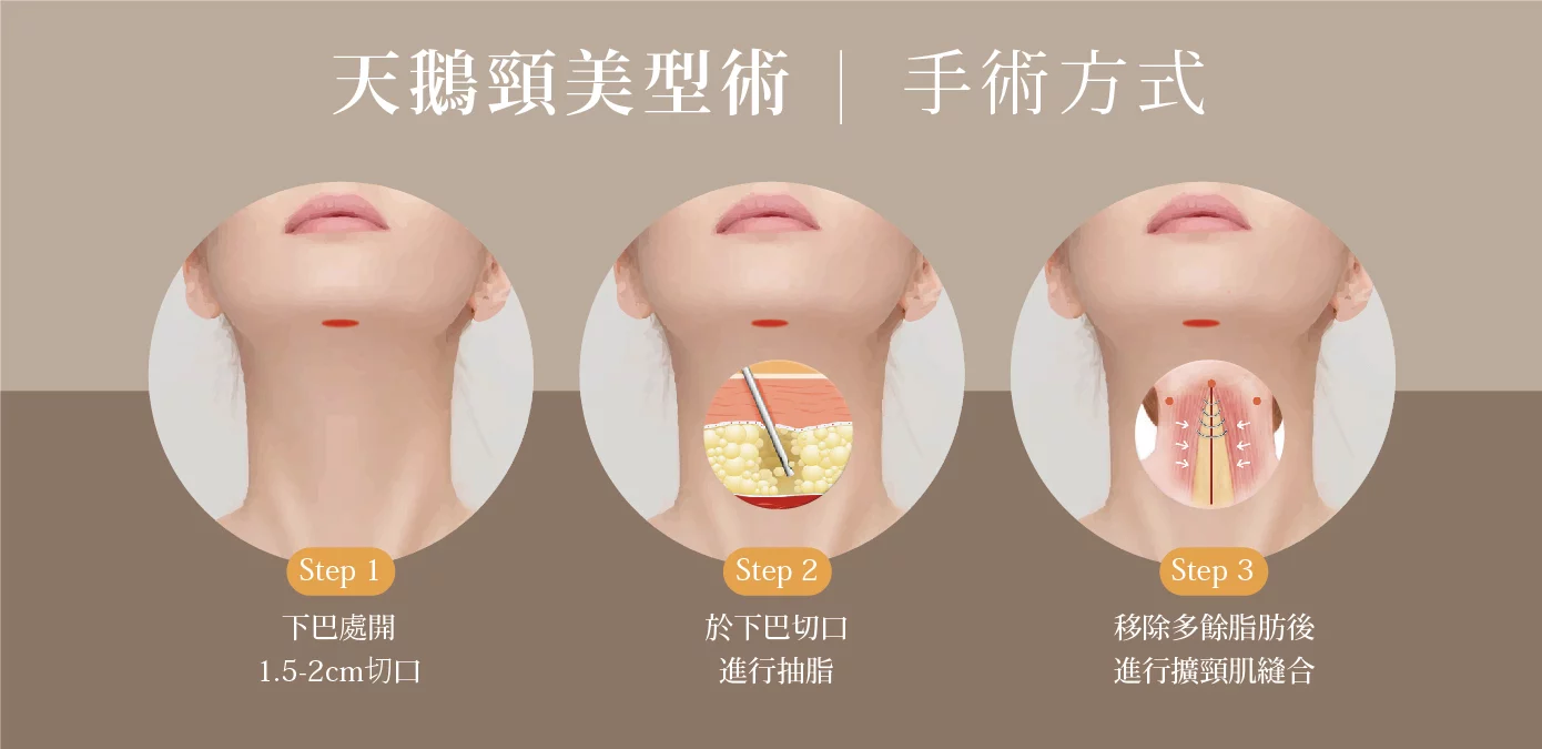 26f91ad318be490fad4eb9f06caf4578