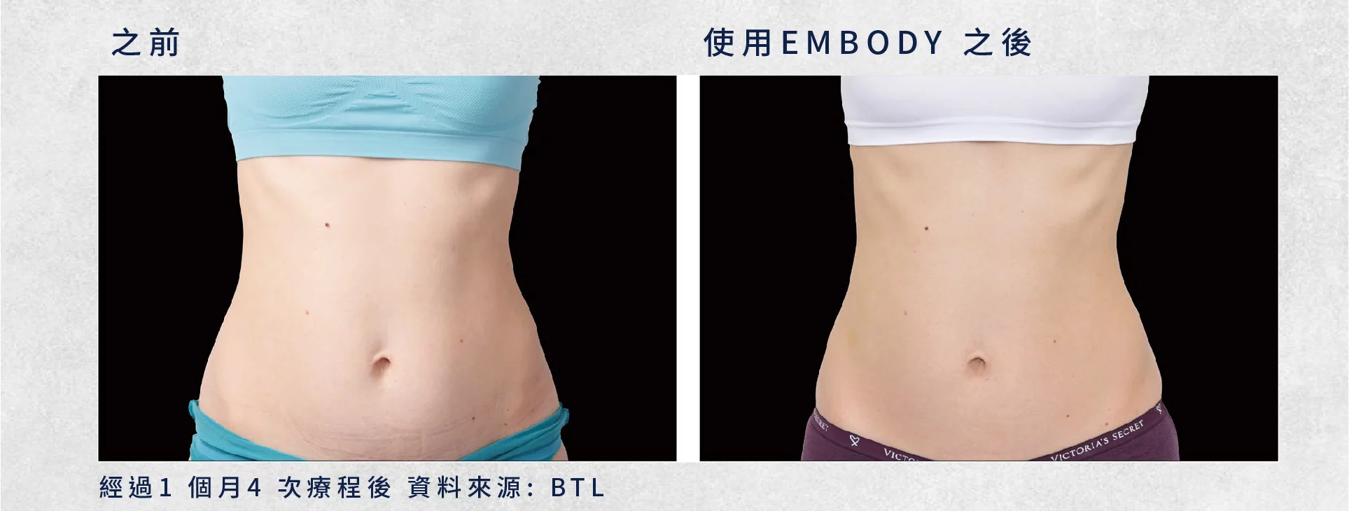 41e60826d17e41558f7837138f5f0be3 2