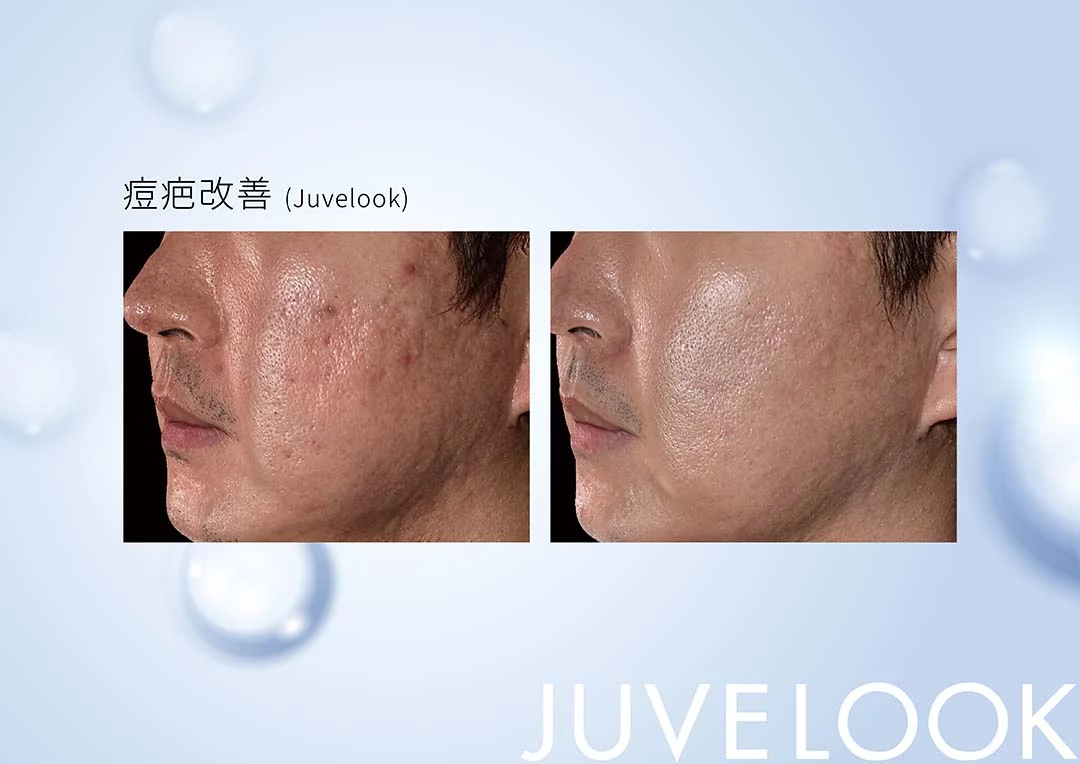 632ac558995c499580b1b931e43e6ee5