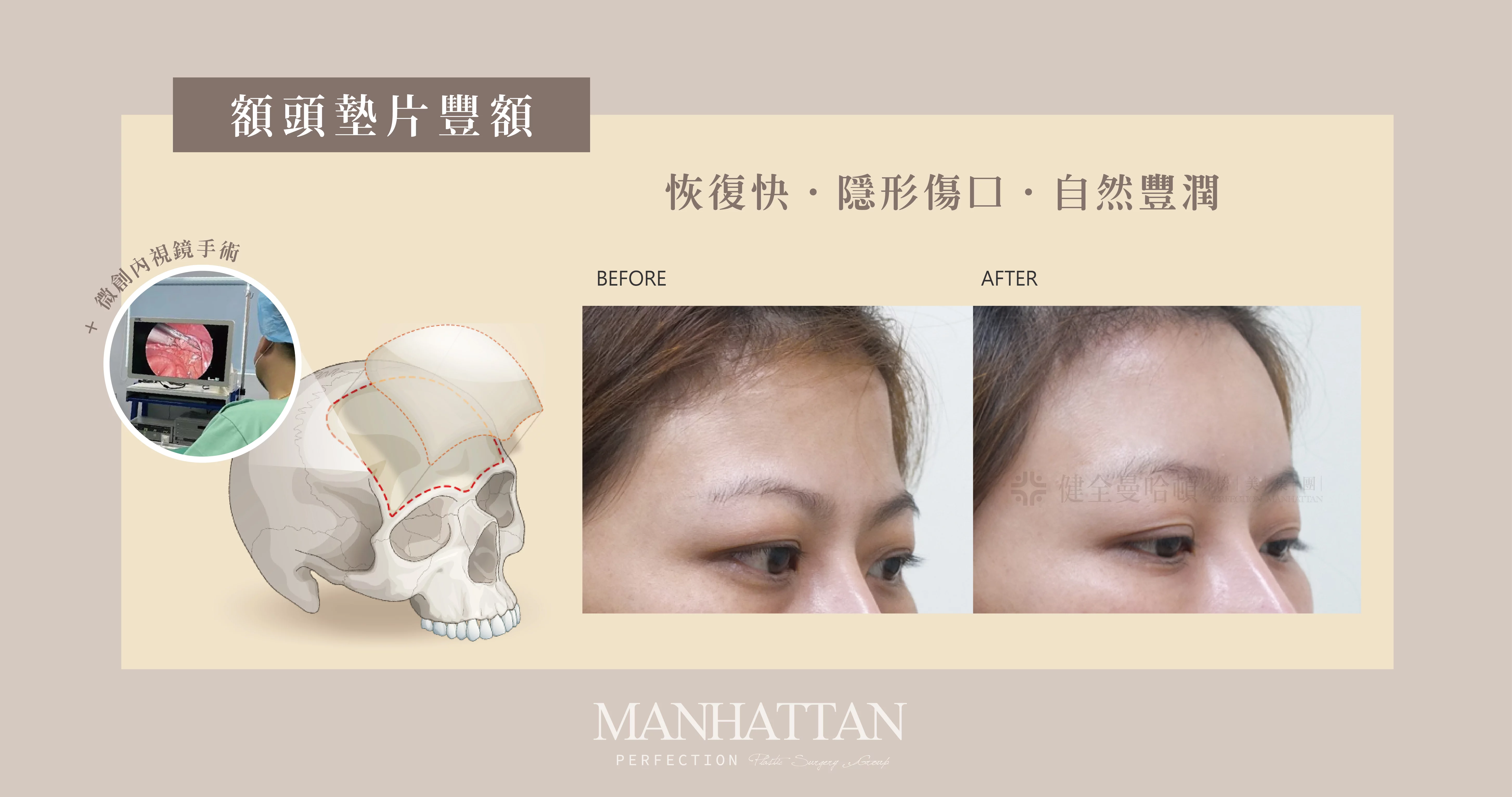 94dbd1f2c6584b48bbc8353ac7133854