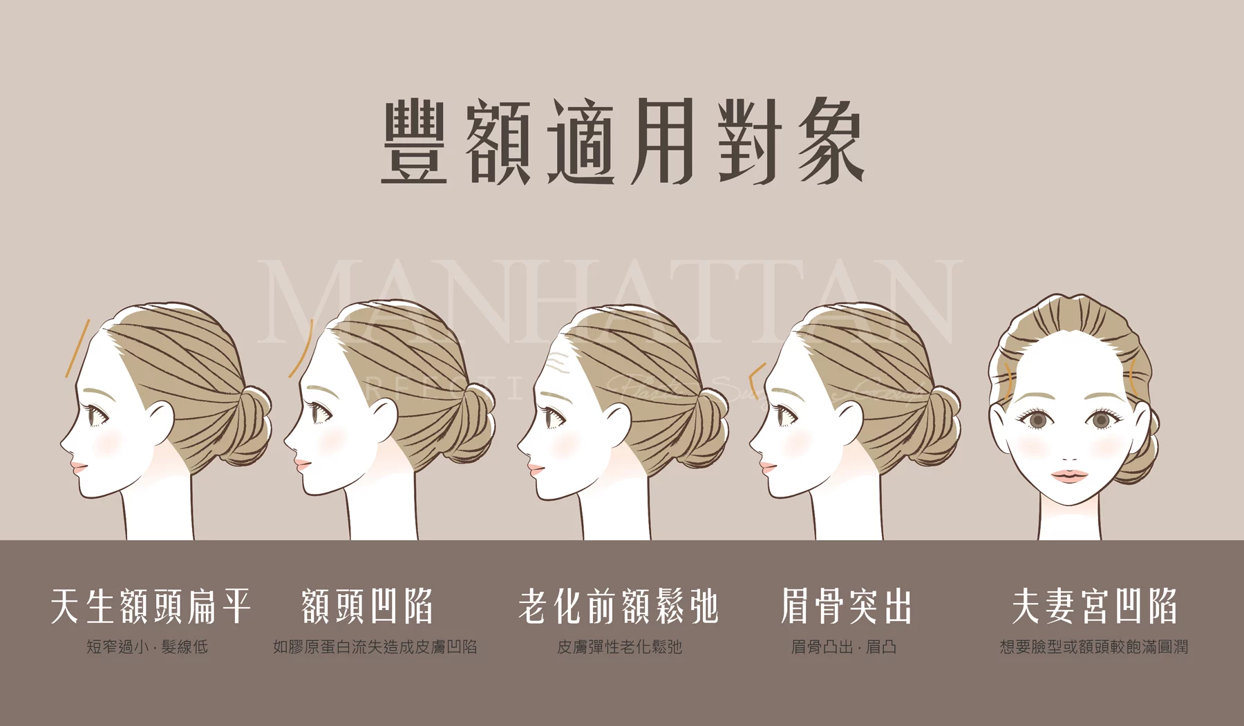 Bff9c49ad5804698b48eef849df30112