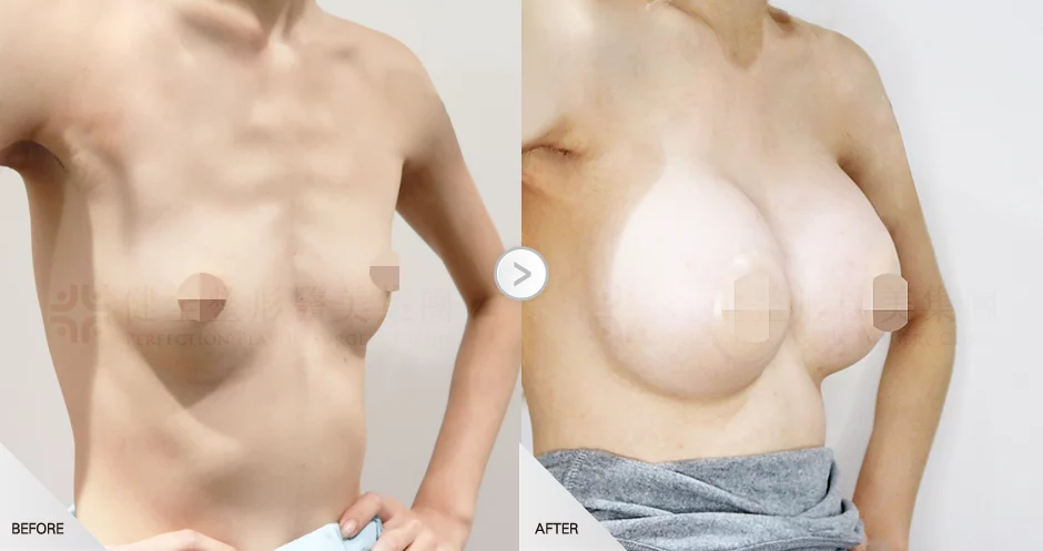 C73023ac81bc460895aeafcfa7b1f2e5