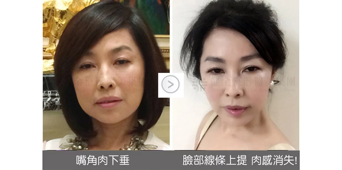 05d62807058e4e399694aa21cf509e09 2