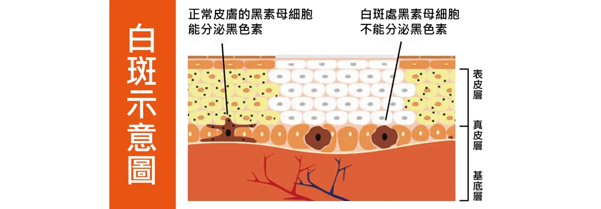 32a788f035cb419faeb5ac5b6dddcd2c