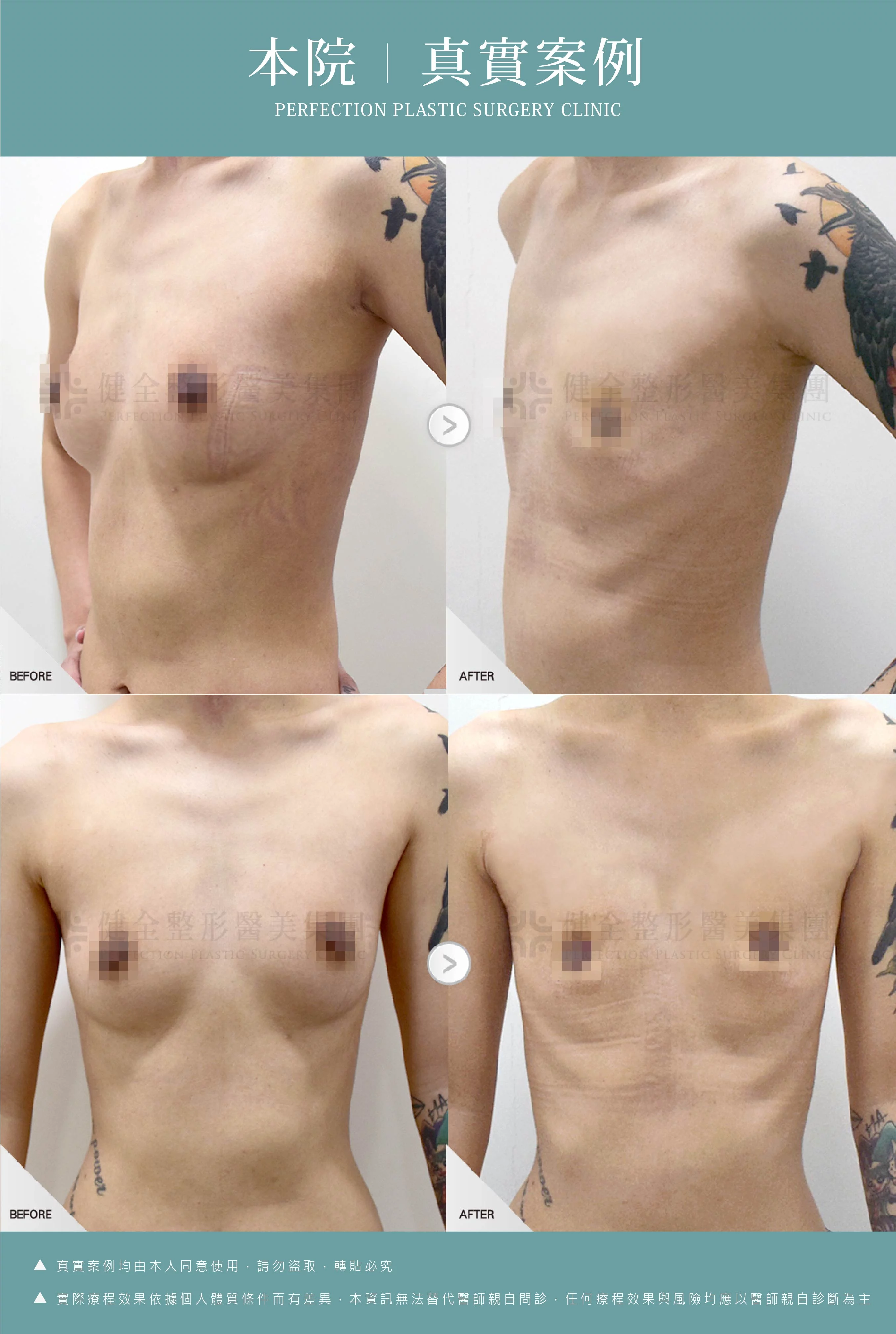 38b1461aef7f4bc087b2c3b31f48d18b