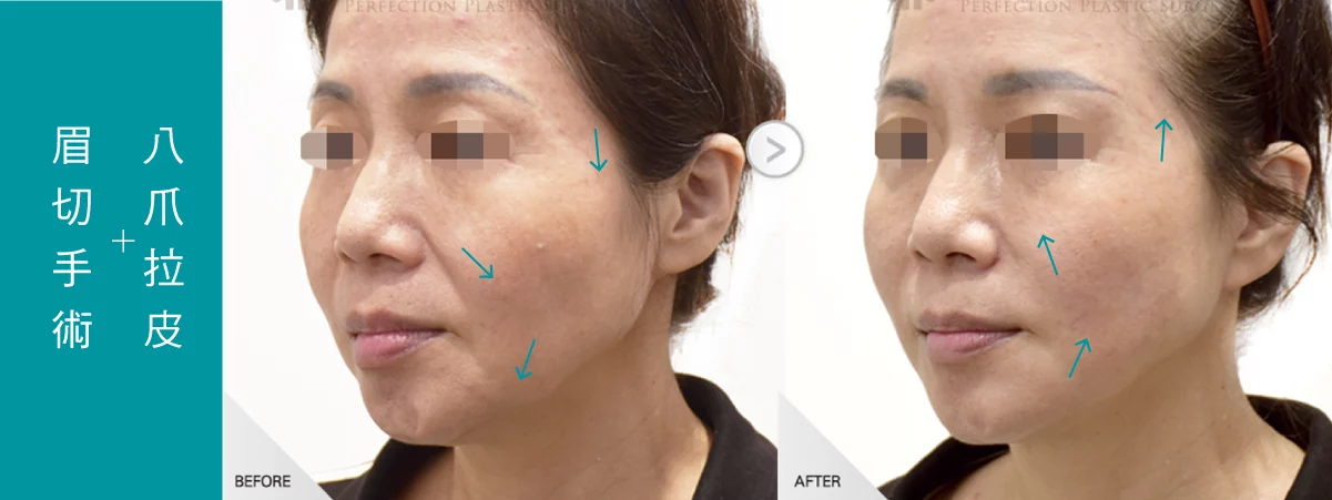 4b6d5d5a23cc4067a29b705f1561b96e 2