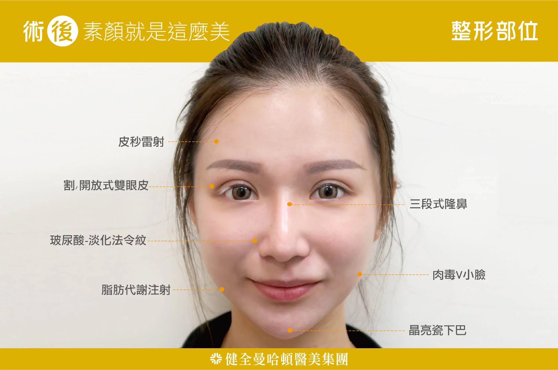 4dc711a73ad6446f8c60d3e73ffb0b81