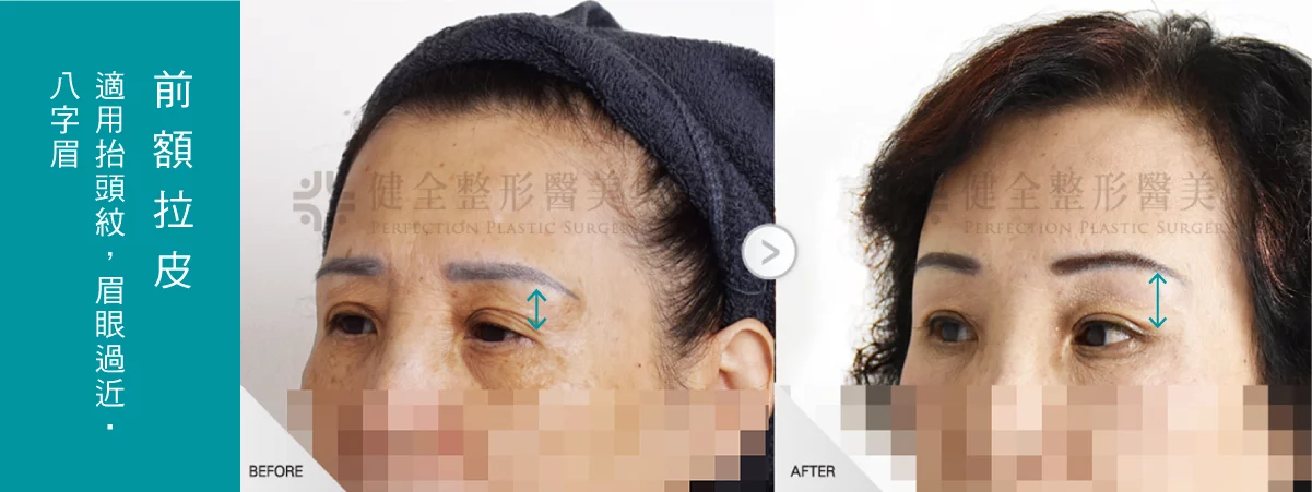 51ae7b8ccae4410baf1b7356181753c3 1