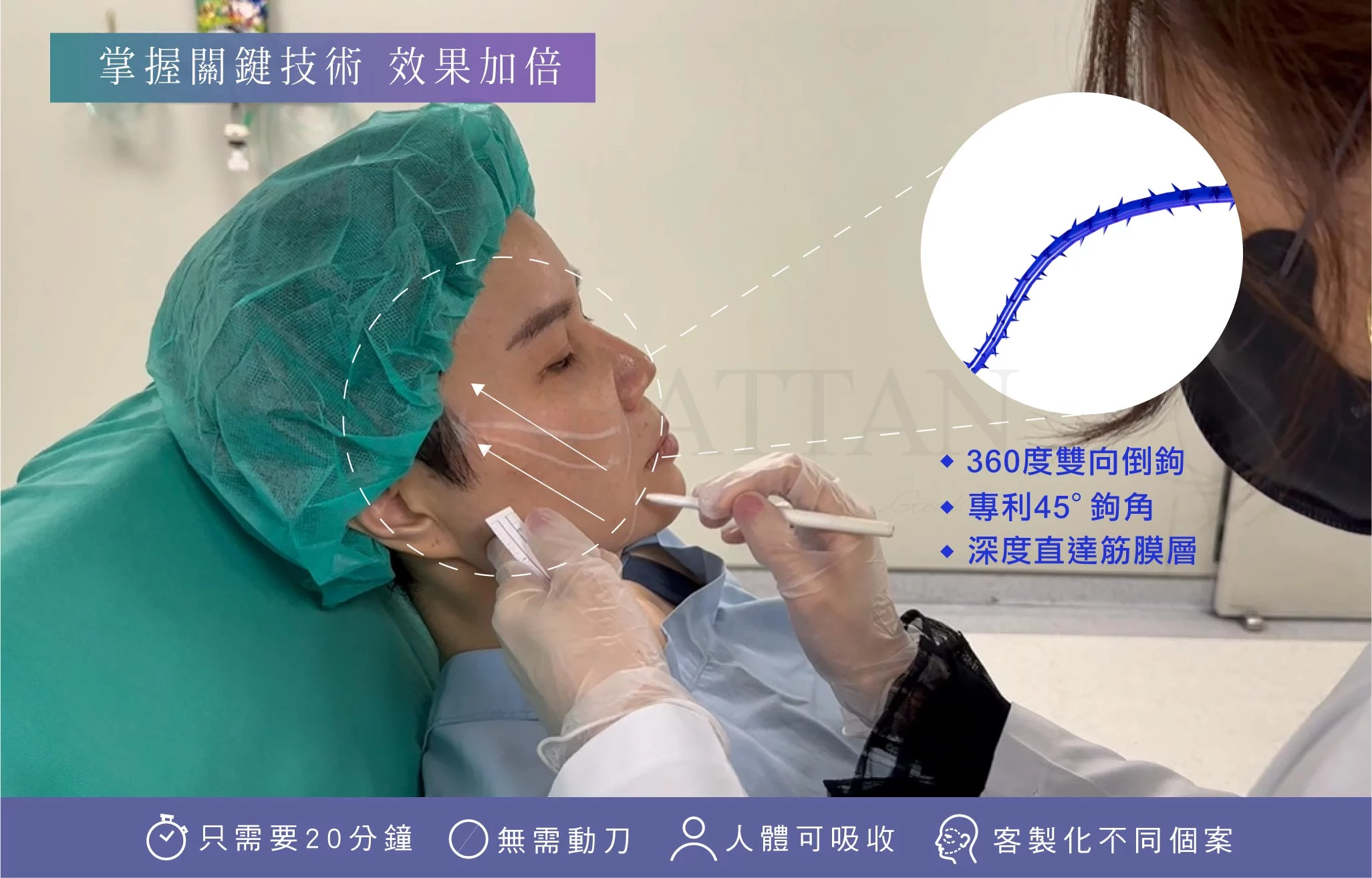 6876a1d8361e47ea862affde48a7ef85 1