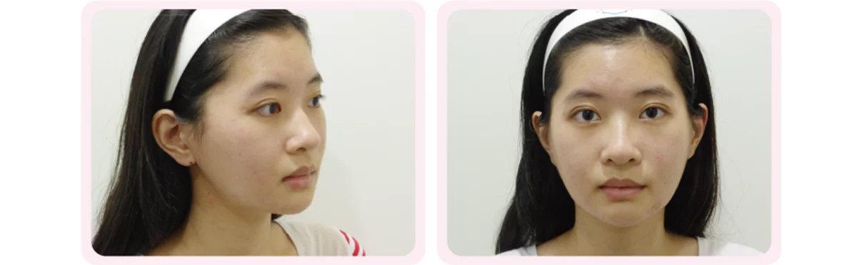 6eb34096364d48db8af0fdce0bd19314