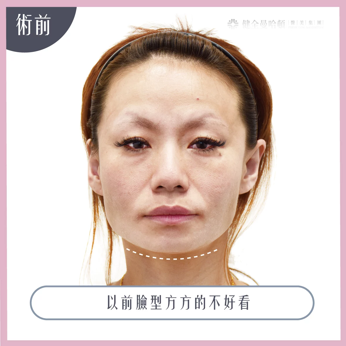 737b4d24049d4966a13e3fdac9ee421f 3