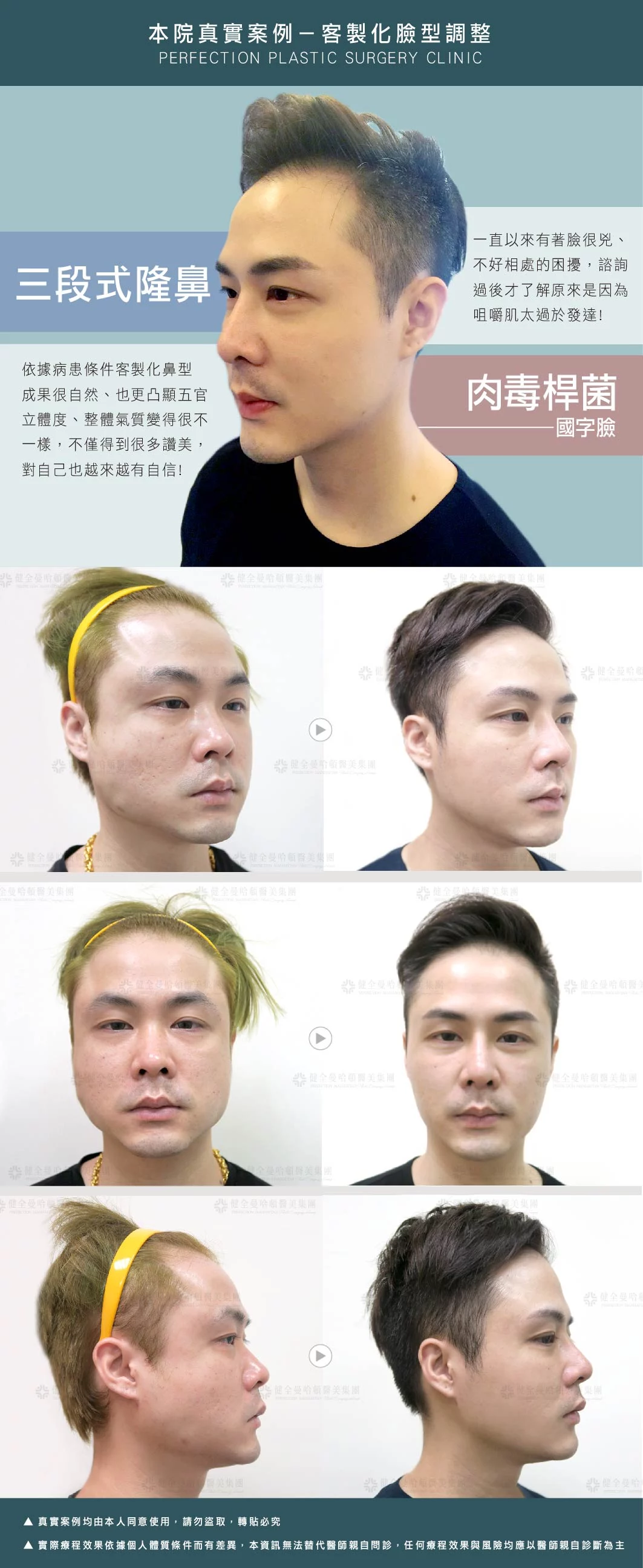 8eb75181b40d40d1801b9a340658ff3d 2