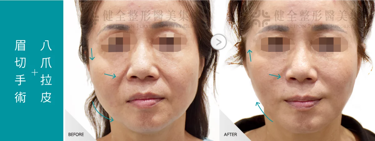 950a336274ef4719b4912638bc5e32e3 2