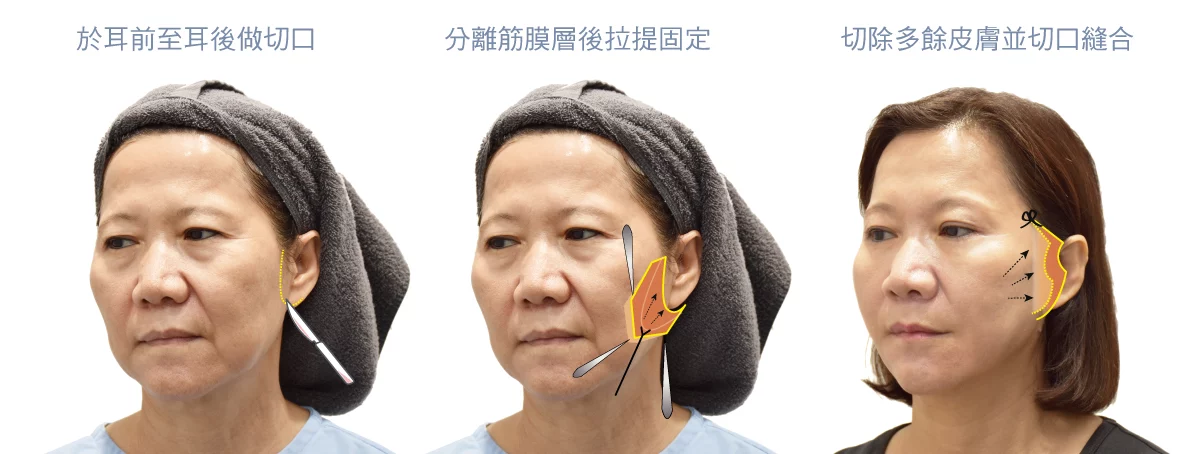 9b69cee0961a4fbfa2e67ccb2e26082b