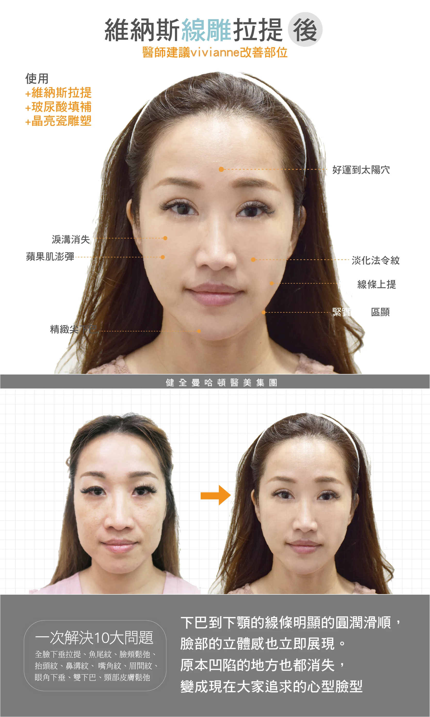 A2dbb0777f3f4877a7546c9ab1768bc1