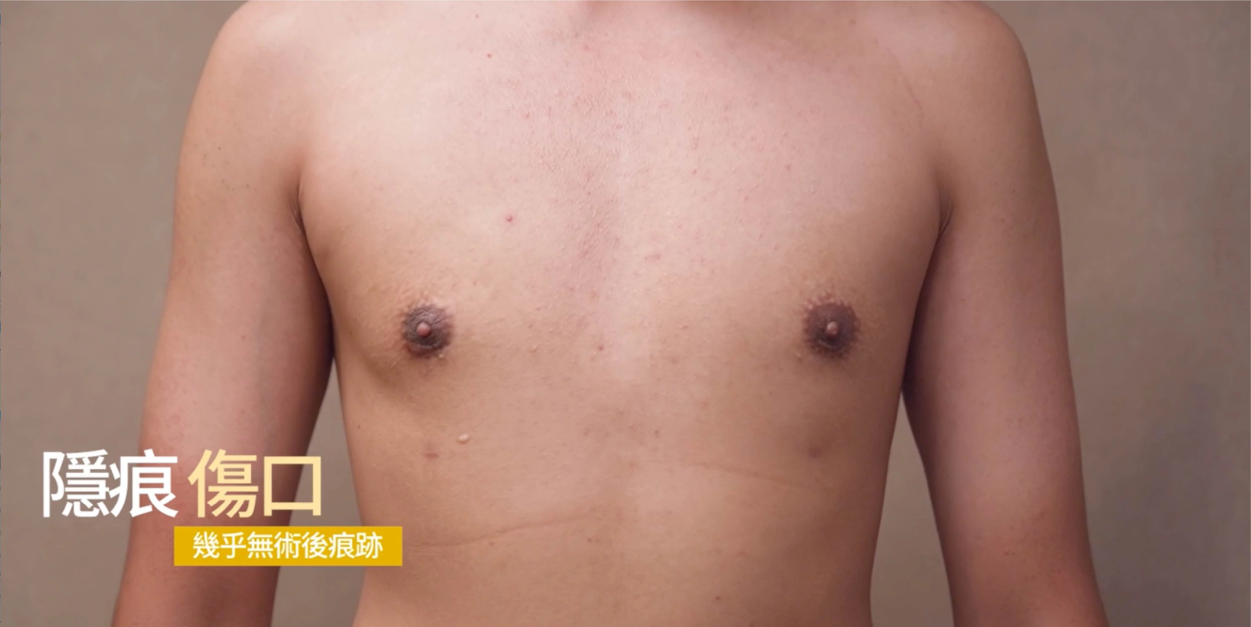 Aa53b3f62ee8402c85a071ca8f1dbcf5