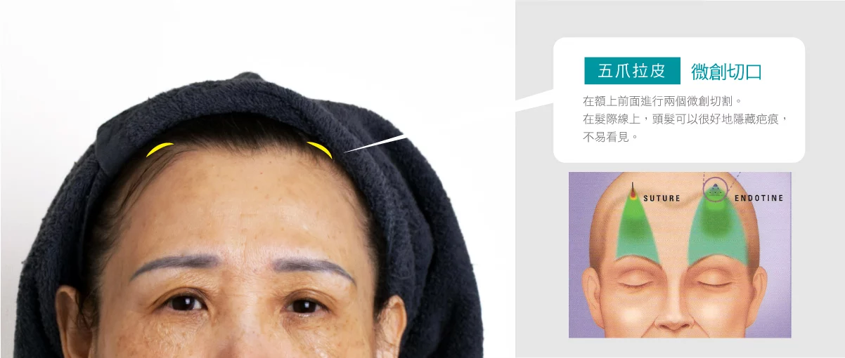 Ad3c0ce194af4e10a608bc9a56b38046 1