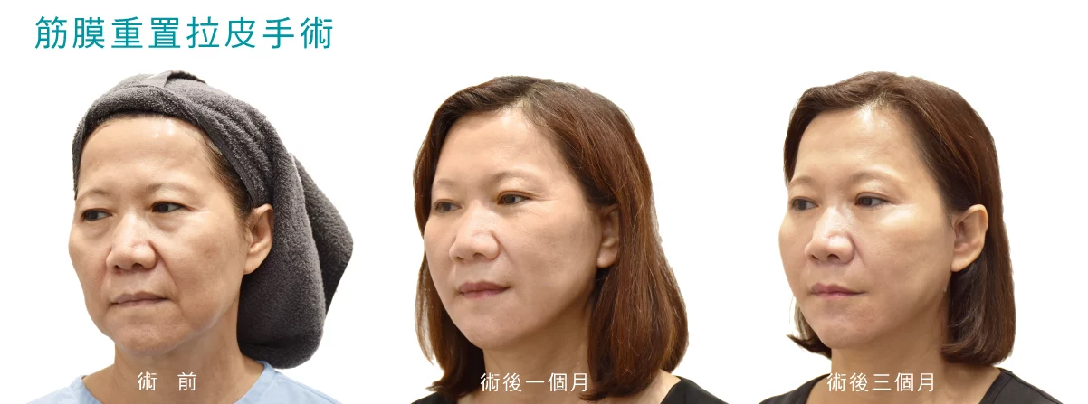 B901d7b402ce4027a14f72602344b594