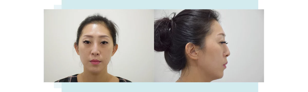 Bf868f90cbb2405eb73260d19c1d2ea5