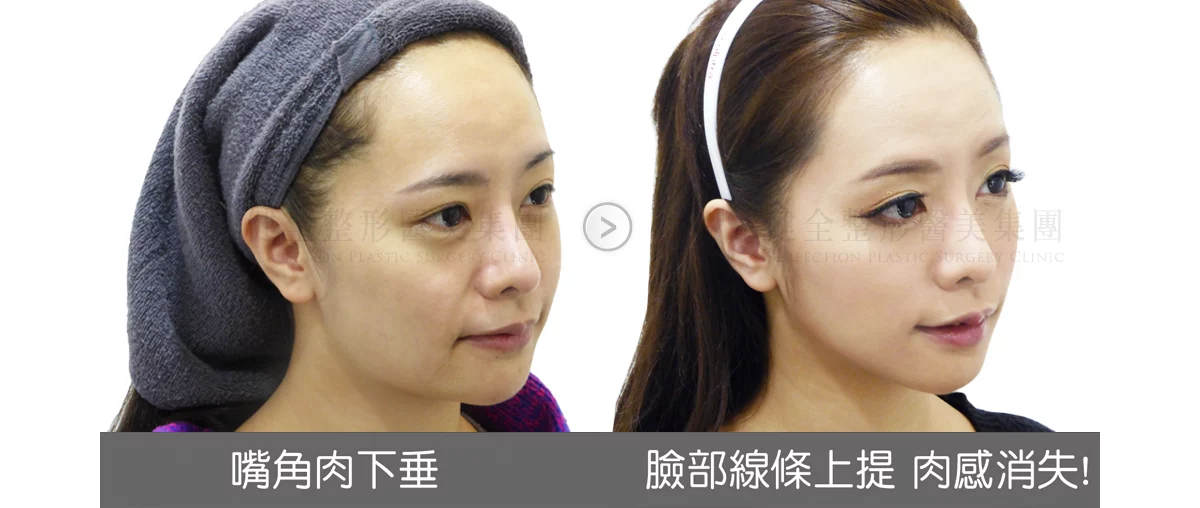 Cc787ce5b9b14ae8a09e2ccd7b21c2e6 2