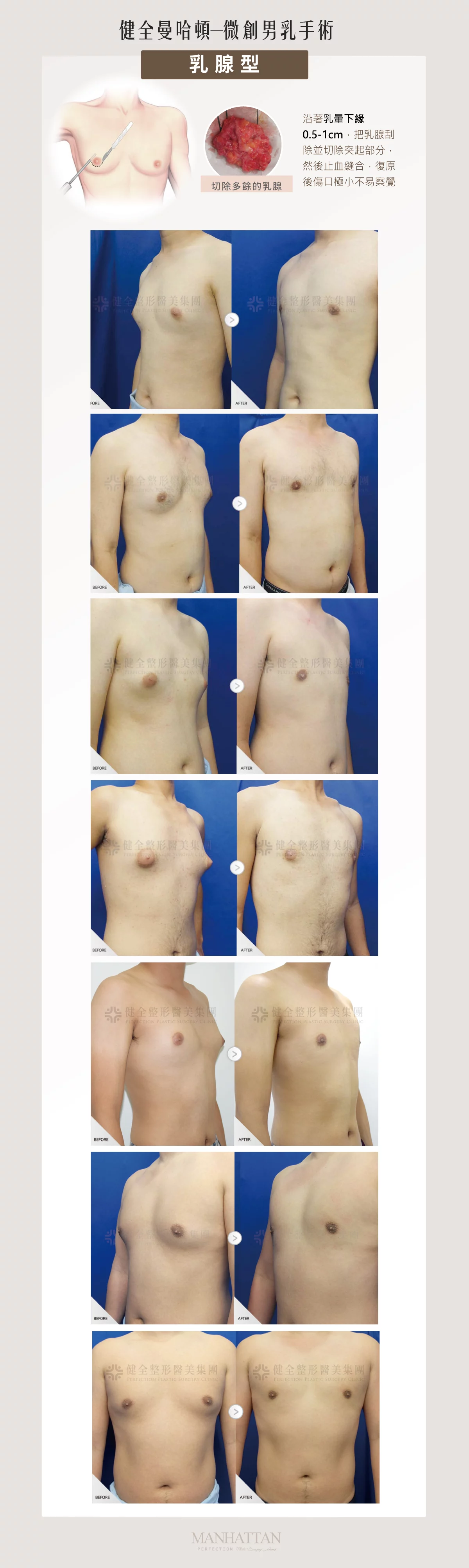 Cf1383efcc2a4d7d8a9e03d88fa507c4