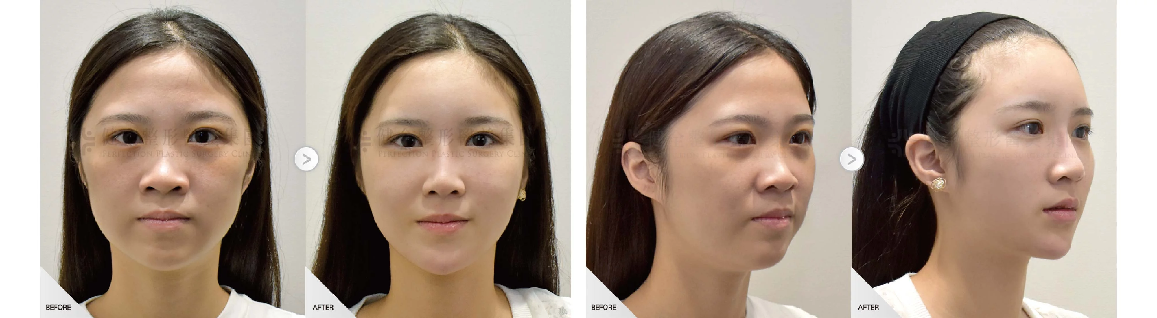 D4127ff4798840778f8cf320bf47134f