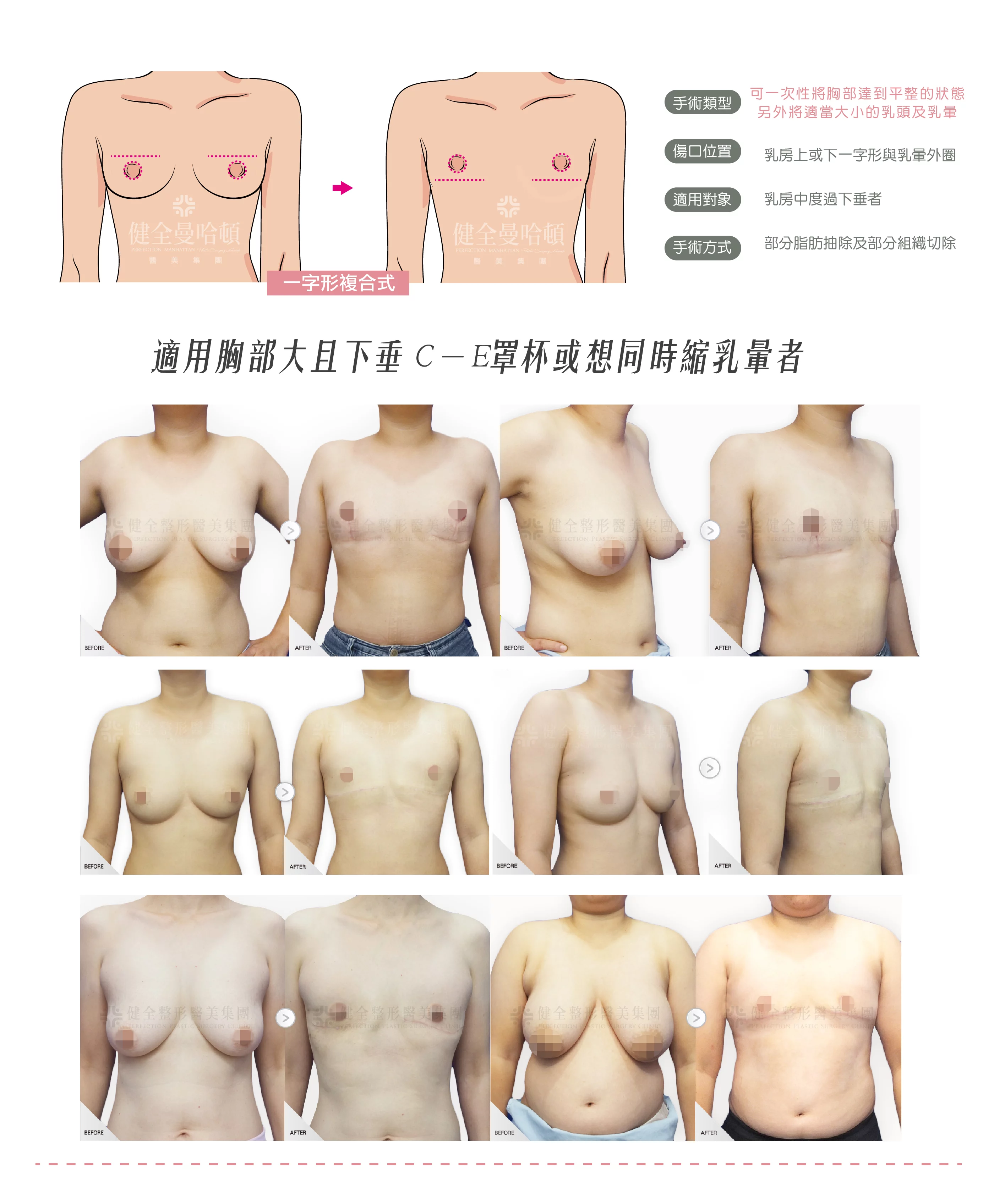 Ebf9adc82f75458e9a5712cc5455fd86