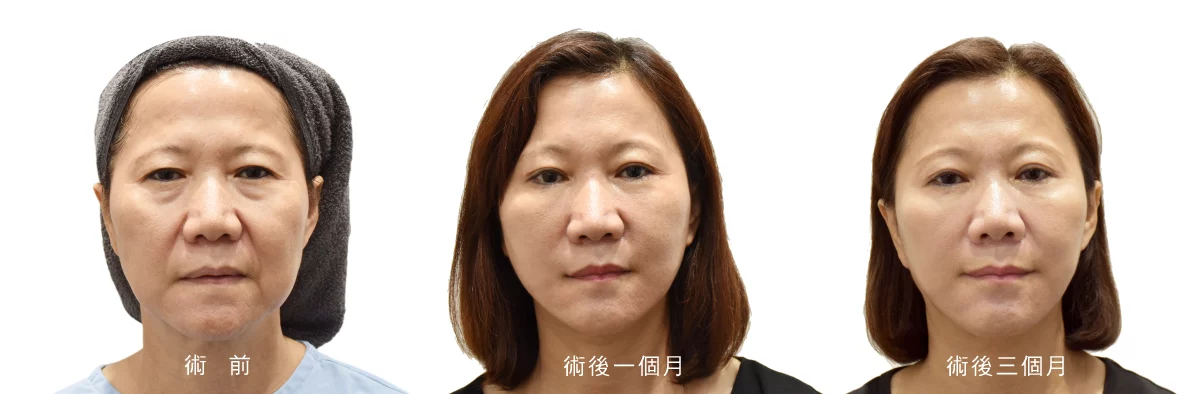 Fff00c4b641f4c9d8758572f98a648ea