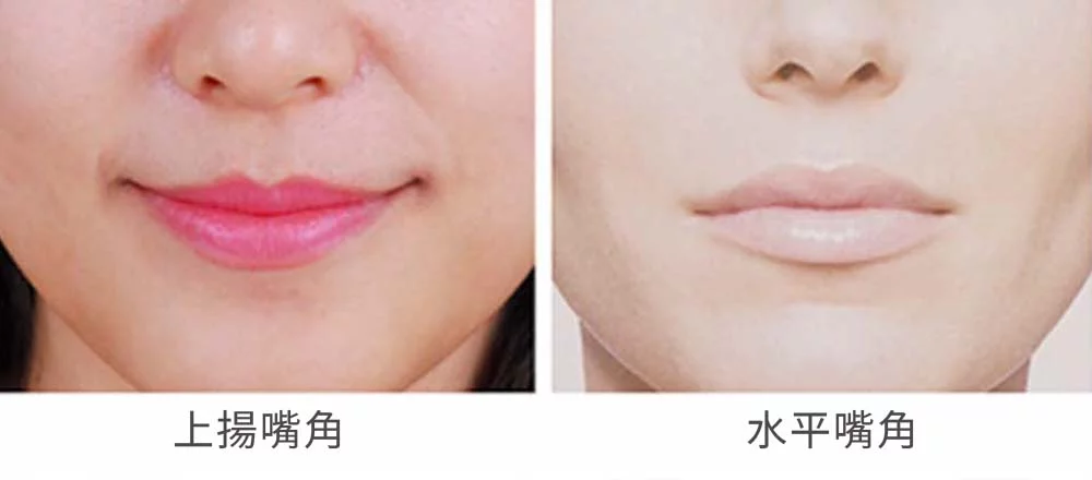 嘴角上揚 03 1