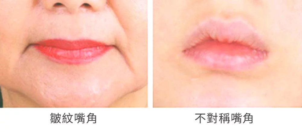 嘴角上揚 03 4