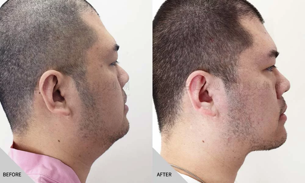 天鵝頸 傅偉傑 02