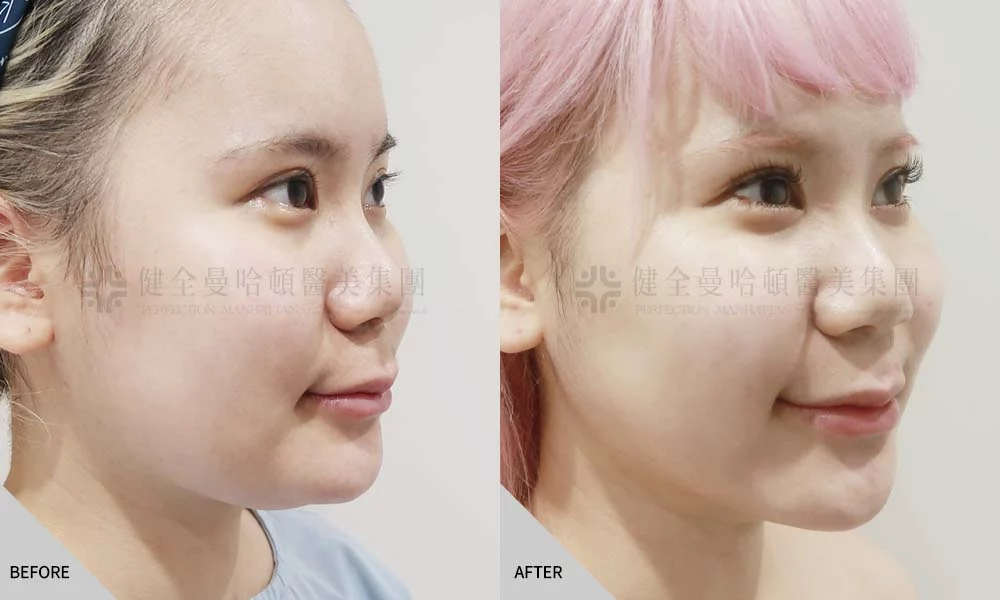 天鵝頸 張瓅勻 01