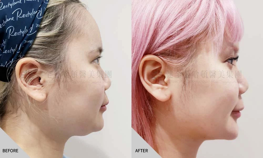 天鵝頸 張瓅勻 02