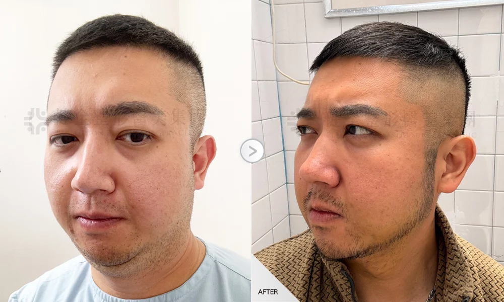 天鵝頸 陳彥伯 01