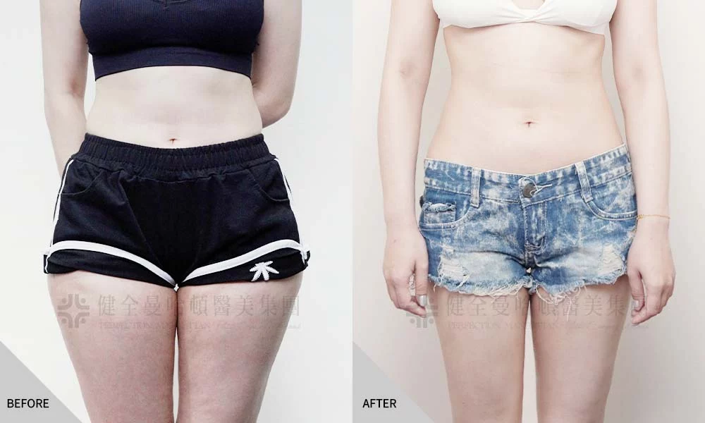 涂佩均 大腿環抽 01