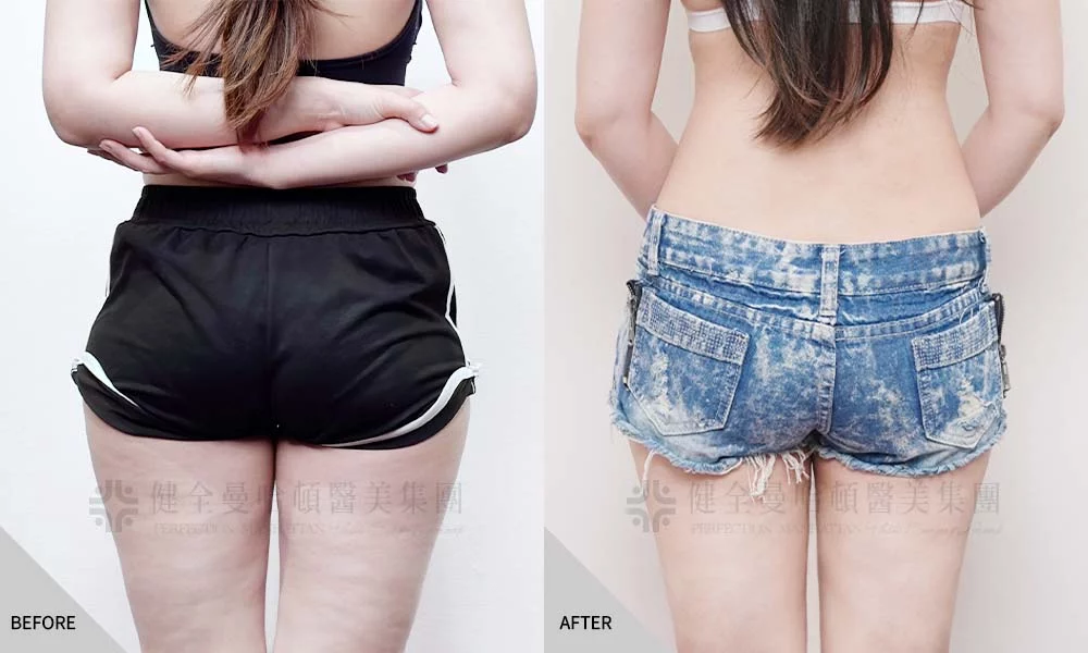 涂佩均 大腿環抽 03