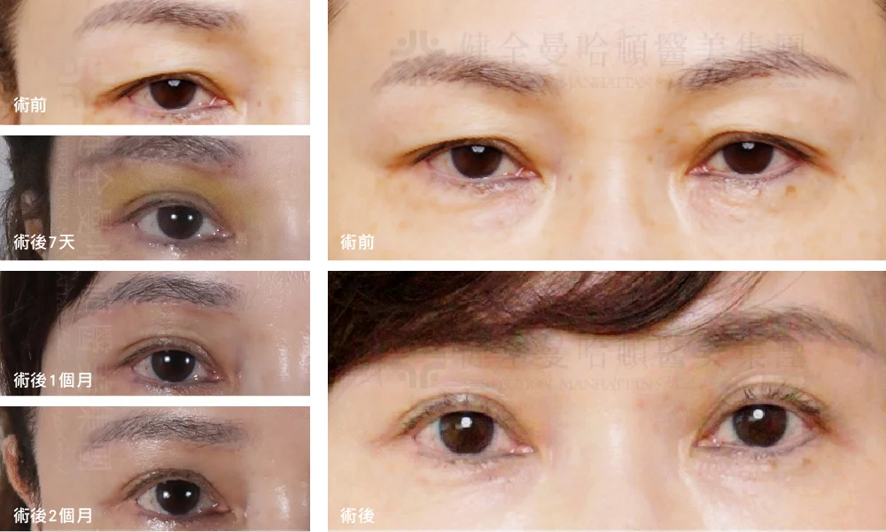 眉切 劉恬良 拼貼