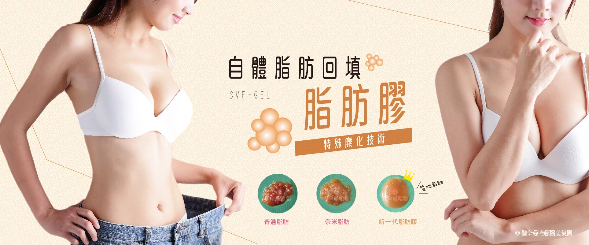 自體脂肪移植 01