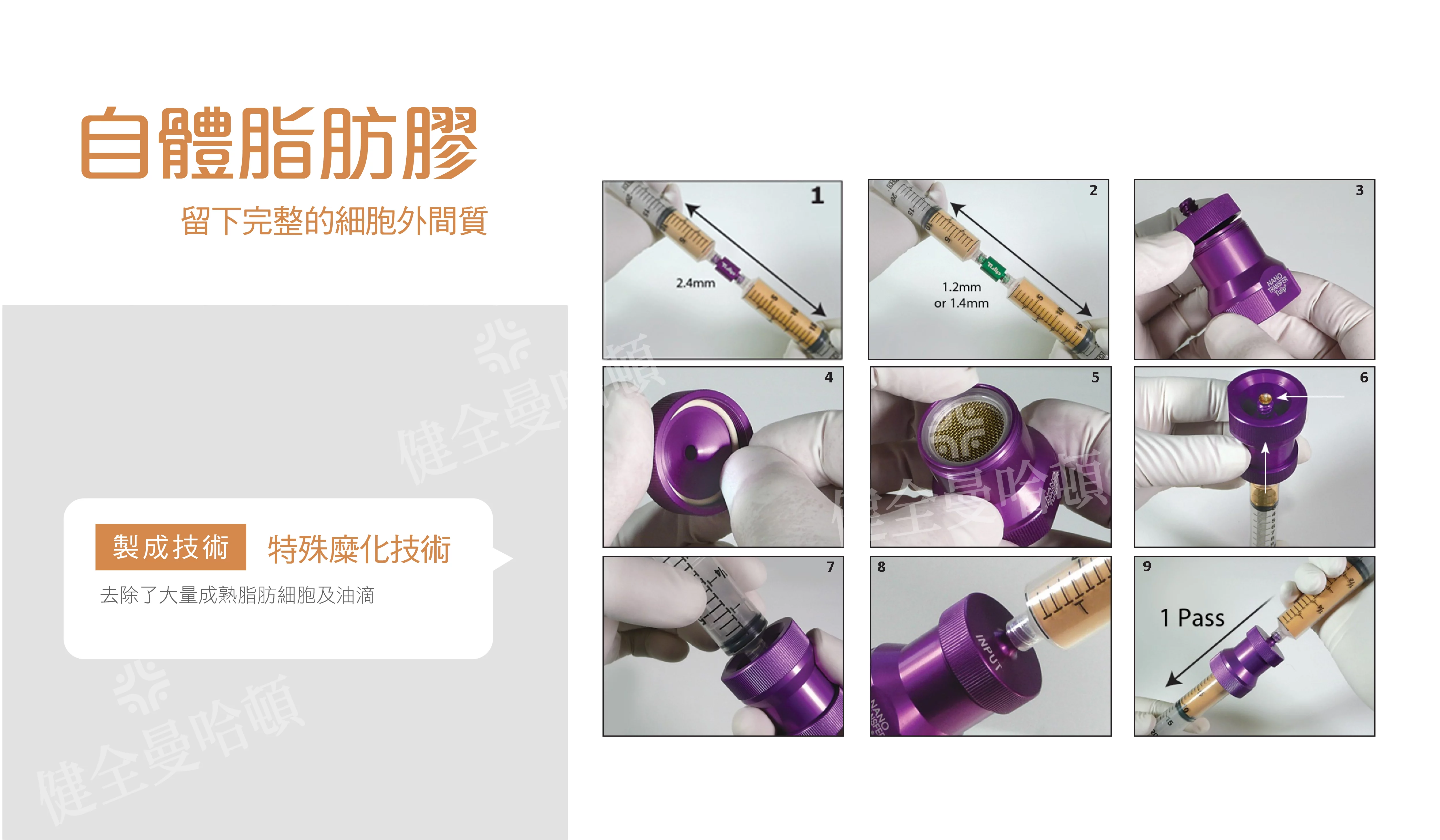 自體脂肪移植 02