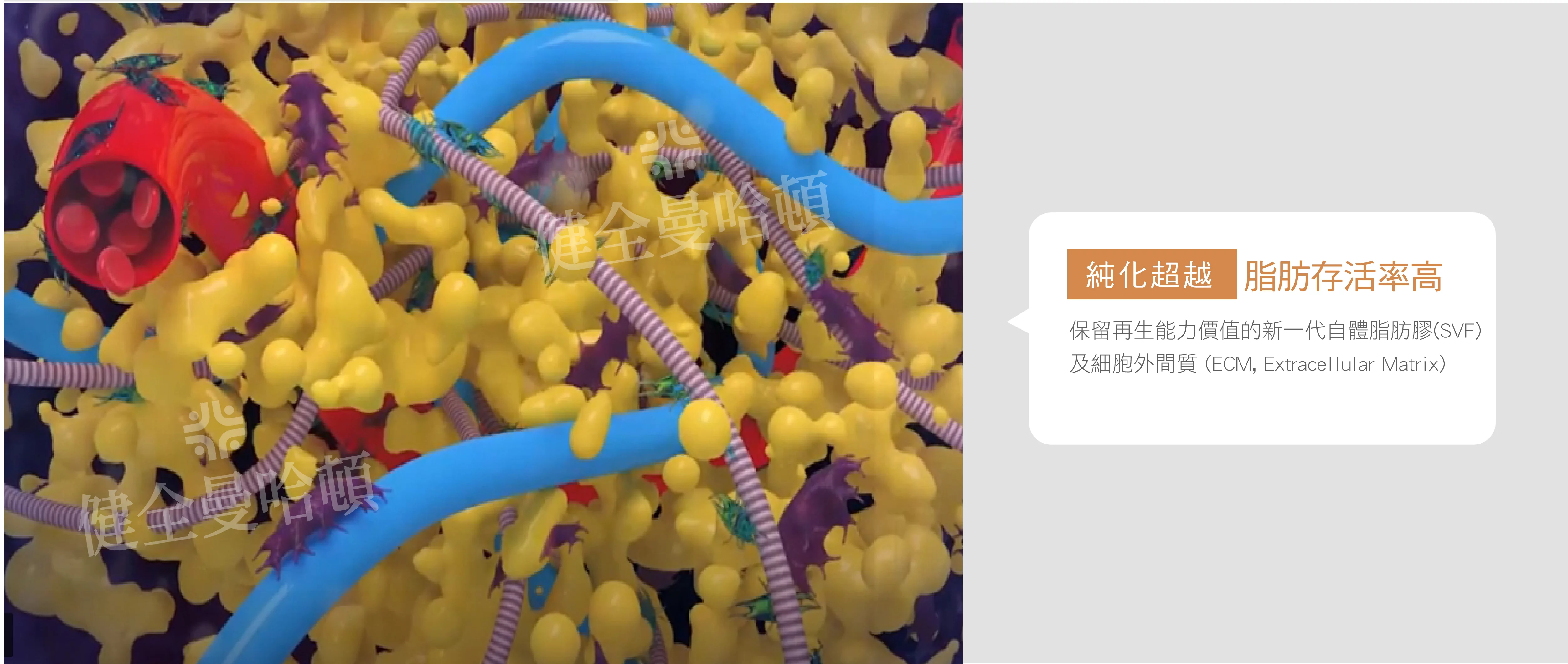 自體脂肪移植 05