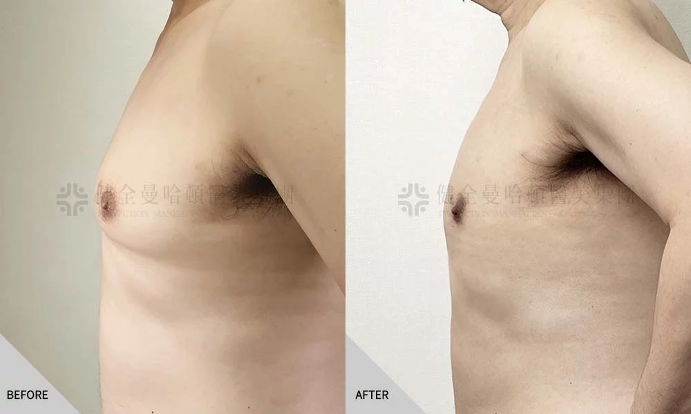 鄭世彬 男性女乳 03