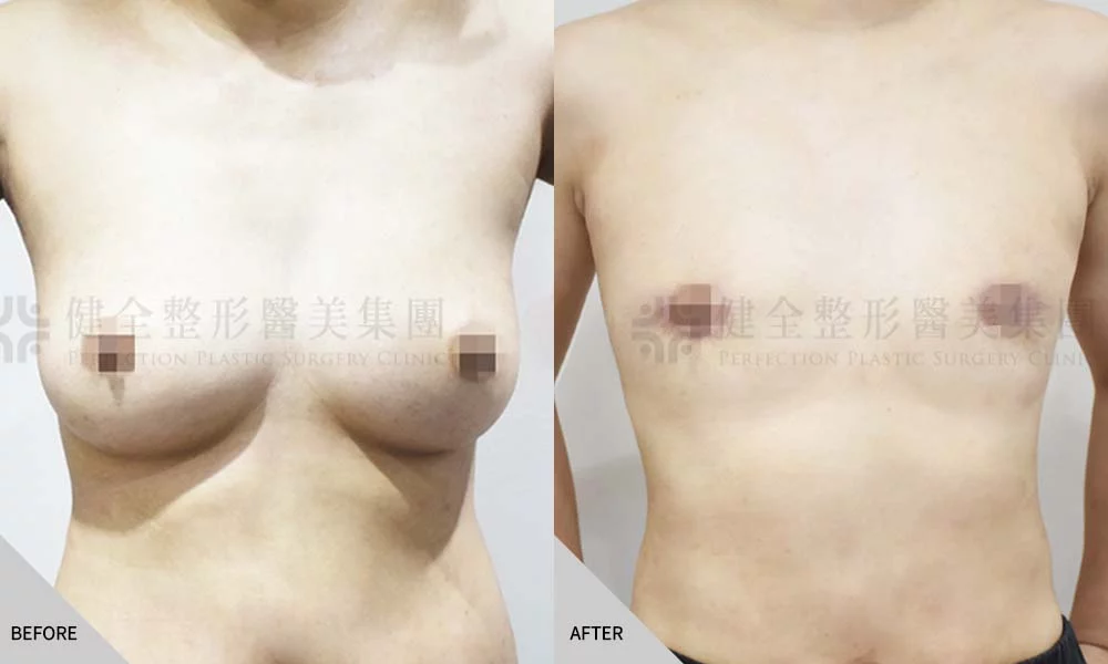 陳姄仁 平胸 01