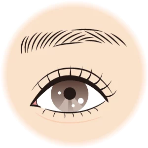 雙眼皮型態 開放式