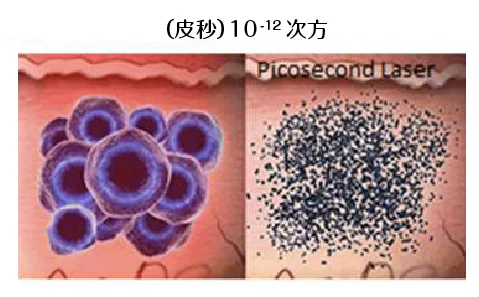 Pico皮秒雷射 皮秒