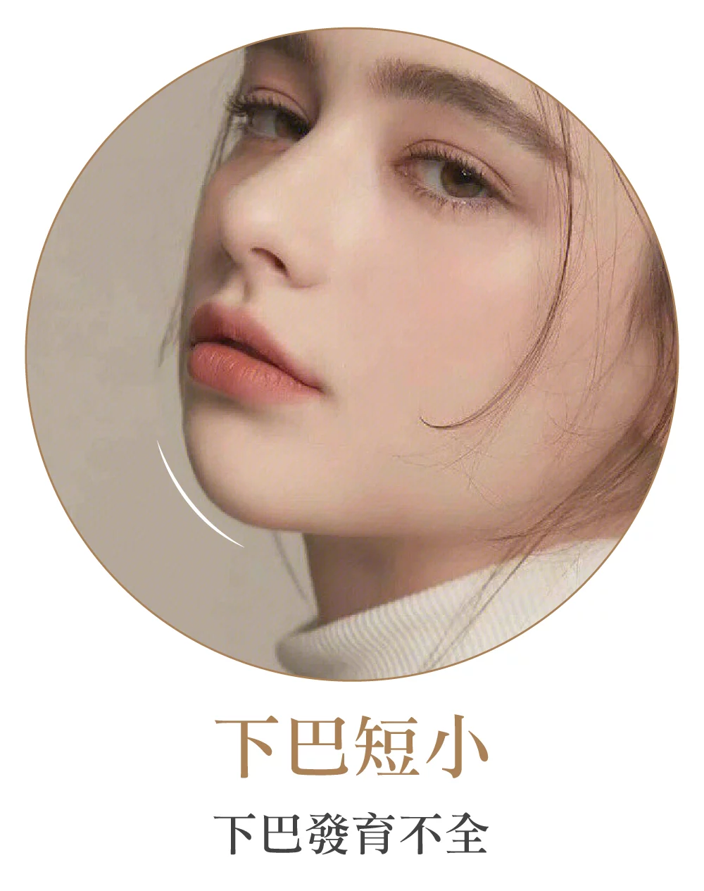 下巴精雕 下巴短小 1