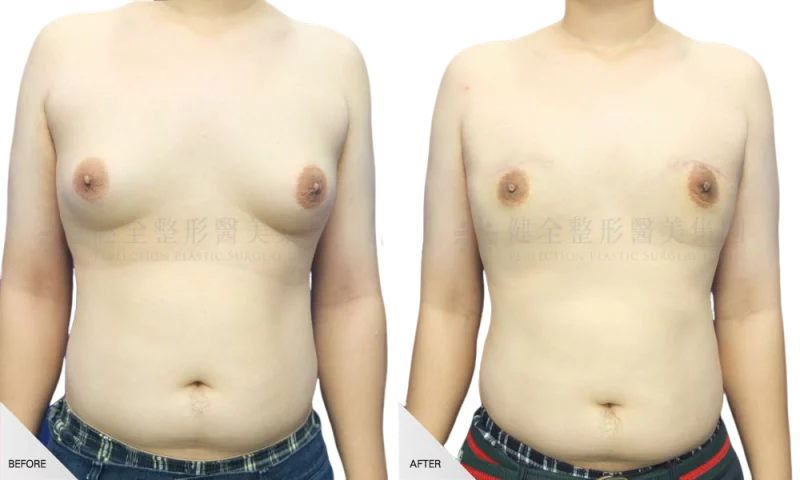 吳仲翔04.11男性女乳一字