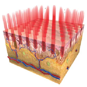 彩衝光梭 凝結式飛梭