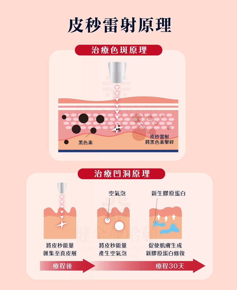 探索皮秒 效果圖