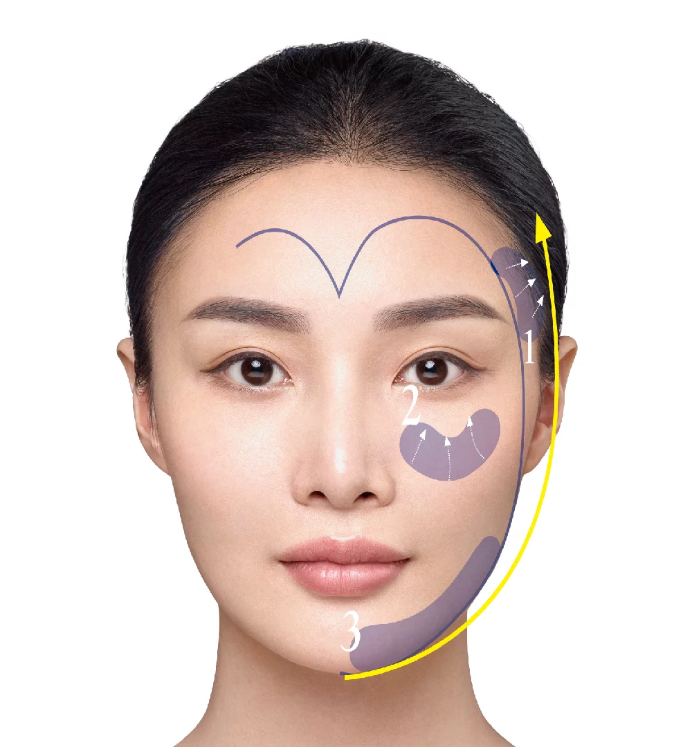 瑞斯朗玻尿酸 心美人圖